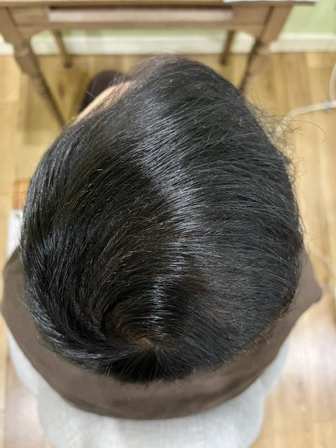 変化後